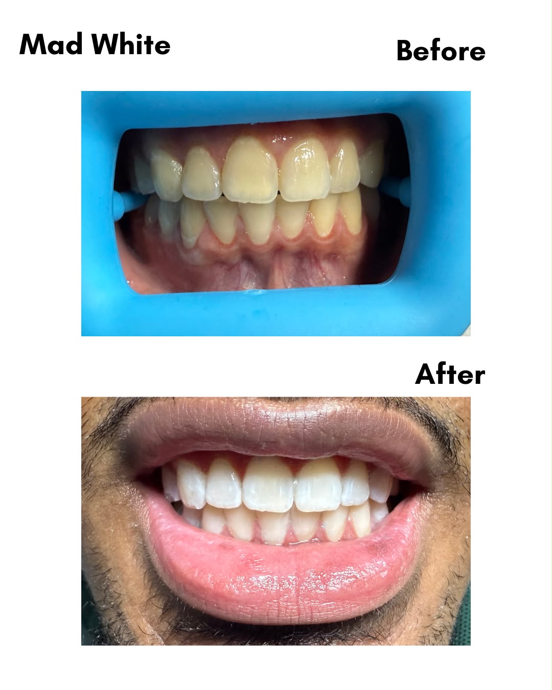 Mad White resultaat — before en after